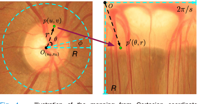 Figure 4 for Disc-aware Ensemble Network for Glaucoma Screening from Fundus Image