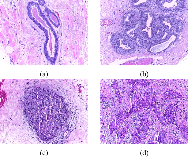 Figure 1 for Breast Cancer Diagnosis with Transfer Learning and Global Pooling