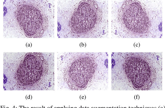 Figure 4 for Breast Cancer Diagnosis with Transfer Learning and Global Pooling