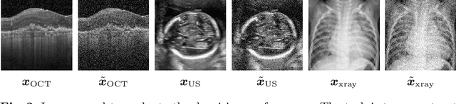 Figure 3 for Uncertainty Estimation in Medical Image Denoising with Bayesian Deep Image Prior