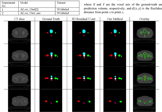 Figure 2 for Semi-supervised Semantic Segmentation of Organs at Risk on 3D Pelvic CT Images
