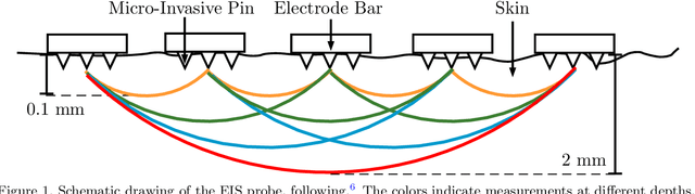 Figure 1 for Melanoma detection with electrical impedance spectroscopy and dermoscopy using joint deep learning models