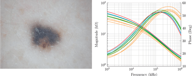 Figure 3 for Melanoma detection with electrical impedance spectroscopy and dermoscopy using joint deep learning models