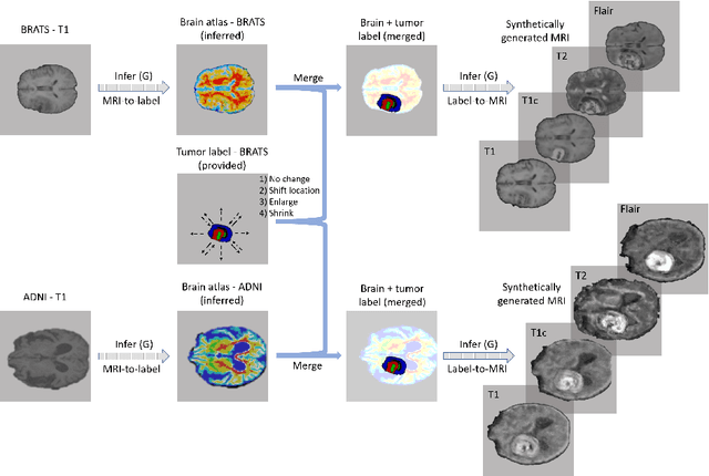 Figure 3 for Medical Image Synthesis for Data Augmentation and Anonymization using Generative Adversarial Networks