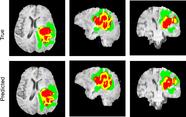 Figure 3 for 3D MRI brain tumor segmentation using autoencoder regularization