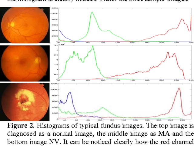 Figure 3 for Classification of Diabetic Retinopathy Images Using Multi-Class Multiple-Instance Learning Based on Color Correlogram Features