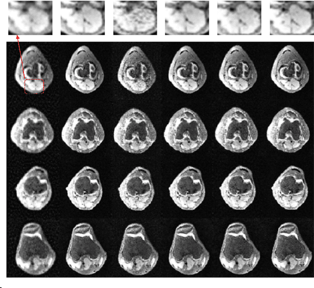 Figure 4 for VAE-GANs for Probabilistic Compressive Image Recovery: Uncertainty Analysis