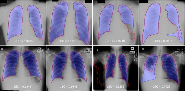 Figure 4 for Accurate Lung Segmentation via Network-Wise Training of Convolutional Networks