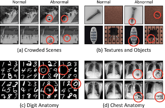 Figure 1 for In-painting Radiography Images for Unsupervised Anomaly Detection