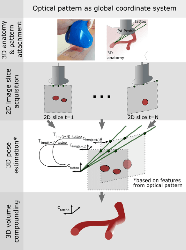 Figure 1 for Tattoo tomography: Freehand 3D photoacoustic image reconstruction with an optical pattern