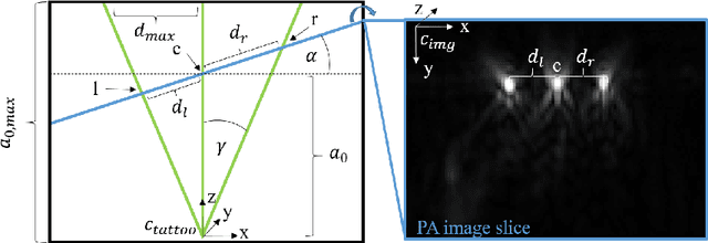 Figure 2 for Tattoo tomography: Freehand 3D photoacoustic image reconstruction with an optical pattern