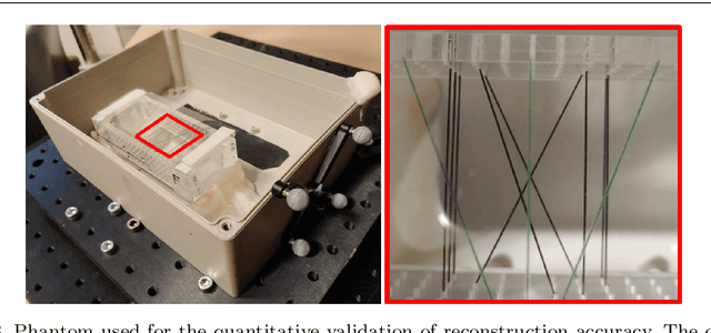 Figure 3 for Tattoo tomography: Freehand 3D photoacoustic image reconstruction with an optical pattern