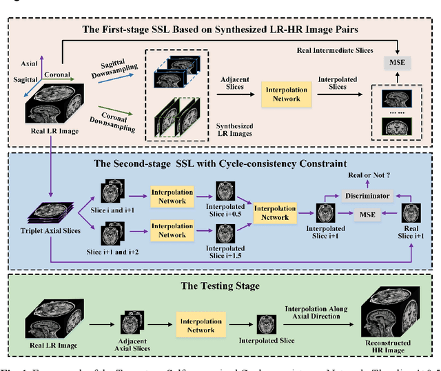 Figure 1 for Two-Stage Self-Supervised Cycle-Consistency Network for Reconstruction of Thin-Slice MR Images