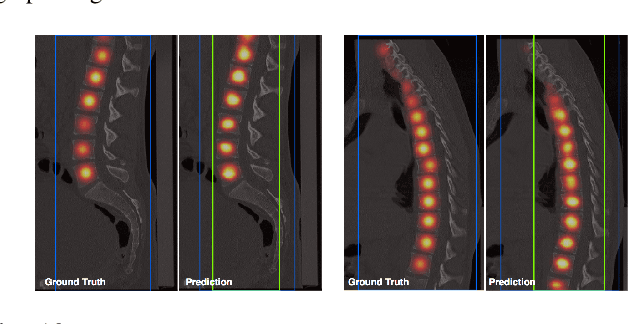 Figure 2 for Adversarially Learning a Local Anatomical Prior: Vertebrae Labelling with 2D reformations