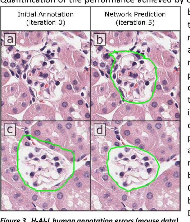 Figure 4 for Iterative annotation to ease neural network training: Specialized machine learning in medical image analysis