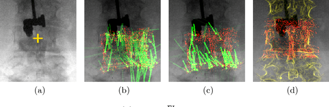 Figure 3 for Metric-Driven Learning of Correspondence Weighting for 2-D/3-D Image Registration