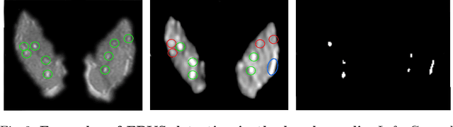 Figure 3 for GP-Unet: Lesion Detection from Weak Labels with a 3D Regression Network