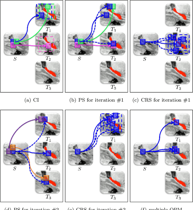 Figure 1 for An Optimized PatchMatch for Multi-scale and Multi-feature Label Fusion