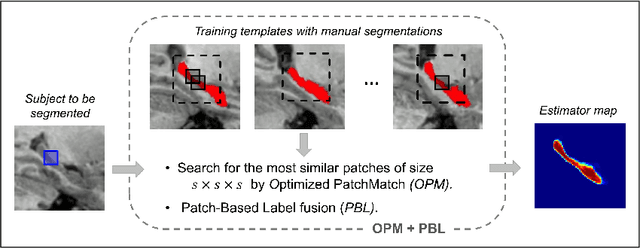 Figure 3 for An Optimized PatchMatch for Multi-scale and Multi-feature Label Fusion