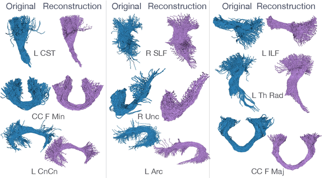 Figure 2 for StreamNet: A WAE for White Matter Streamline Analysis