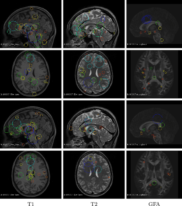Figure 3 for Multi-modal analysis of genetically-related subjects using SIFT descriptors in brain MRI