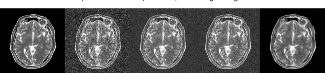 Figure 2 for Supervised Denoising of Diffusion-Weighted Magnetic Resonance Images Using a Convolutional Neural Network and Transfer Learning