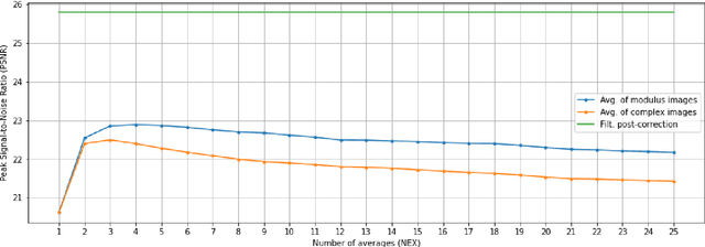 Figure 3 for Supervised Denoising of Diffusion-Weighted Magnetic Resonance Images Using a Convolutional Neural Network and Transfer Learning