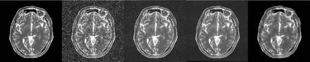 Figure 4 for Supervised Denoising of Diffusion-Weighted Magnetic Resonance Images Using a Convolutional Neural Network and Transfer Learning