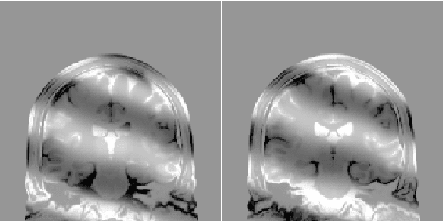 Figure 1 for Supervised Denoising of Diffusion-Weighted Magnetic Resonance Images Using a Convolutional Neural Network and Transfer Learning
