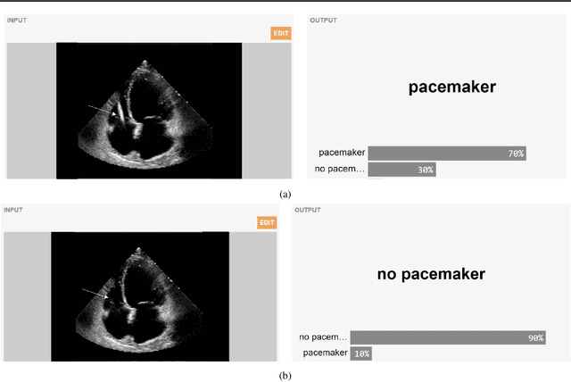 Figure 3 for Gradio: Hassle-Free Sharing and Testing of ML Models in the Wild