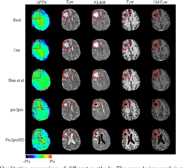 Figure 3 for Lesion Mask-based Simultaneous Synthesis of Anatomic and MolecularMR Images using a GAN