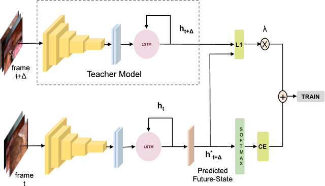 Figure 3 for Future-State Predicting LSTM for Early Surgery Type Recognition