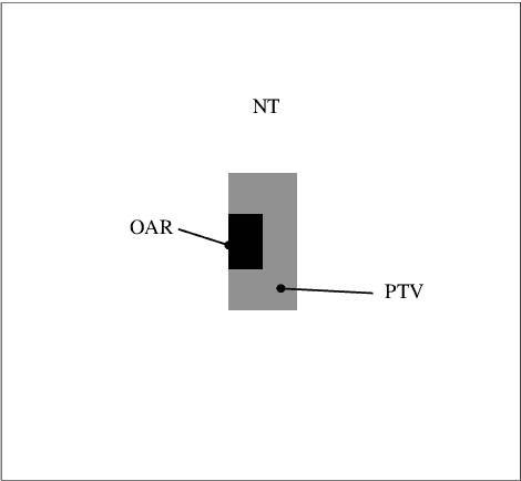 Figure 1 for Variable length genetic algorithm with continuous parameters optimization of beam layout in proton therapy