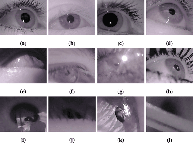 Figure 1 for Labeled pupils in the wild: A dataset for studying pupil detection in unconstrained environments