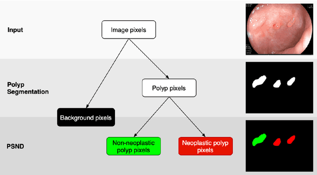 Figure 1 for BlazeNeo: Blazing fast polyp segmentation and neoplasm detection
