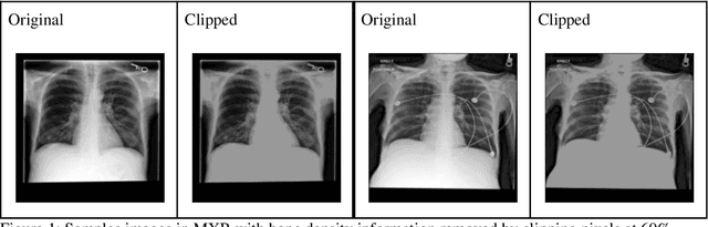 Figure 2 for Reading Race: AI Recognises Patient's Racial Identity In Medical Images