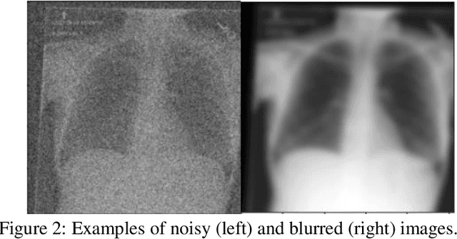 Figure 4 for Reading Race: AI Recognises Patient's Racial Identity In Medical Images