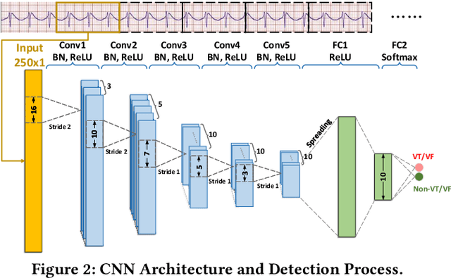 Figure 2 for Personalized Deep Learning for Ventricular Arrhythmias Detection on Medical IoT Systems