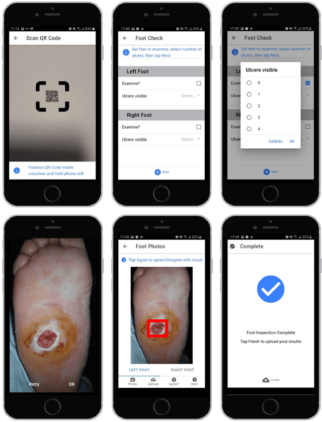 Figure 3 for A Cloud-based Deep Learning Framework for Remote Detection of Diabetic Foot Ulcers