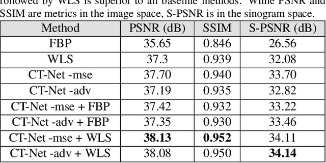 Figure 2 for Lose The Views: Limited Angle CT Reconstruction via Implicit Sinogram Completion