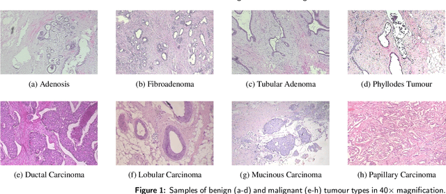 Figure 2 for Classification of Breast Tumours Based on Histopathology Images Using Deep Features and Ensemble of Gradient Boosting Methods