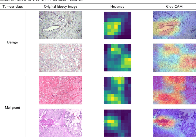 Figure 3 for Classification of Breast Tumours Based on Histopathology Images Using Deep Features and Ensemble of Gradient Boosting Methods