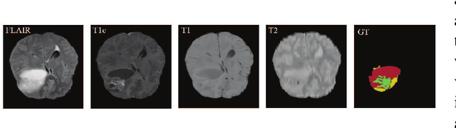 Figure 1 for 3D Medical Multi-modal Segmentation Network Guided by Multi-source Correlation Constraint
