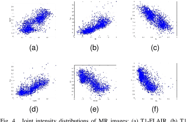 Figure 4 for 3D Medical Multi-modal Segmentation Network Guided by Multi-source Correlation Constraint