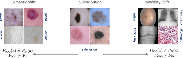 Figure 3 for Revisiting Inlier and Outlier Specification for Improved Out-of-Distribution Detection