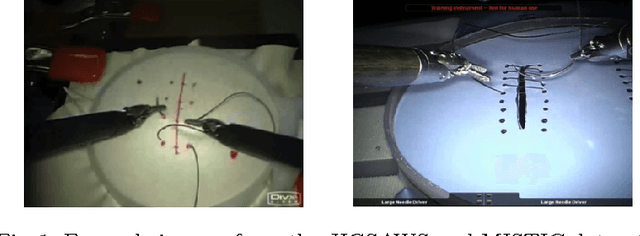 Figure 1 for Recognizing Surgical Activities with Recurrent Neural Networks