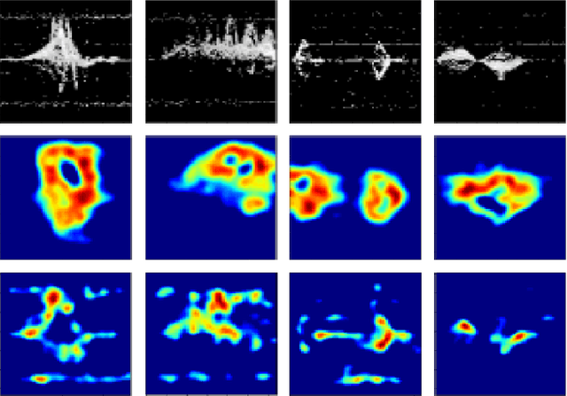 Figure 4 for Motion Classification using Kinematically Sifted ACGAN-Synthesized Radar Micro-Doppler Signatures