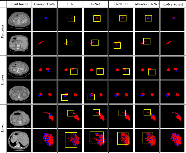 Figure 3 for w-Net: Dual Supervised Medical Image Segmentation Model with Multi-Dimensional Attention and Cascade Multi-Scale Convolution