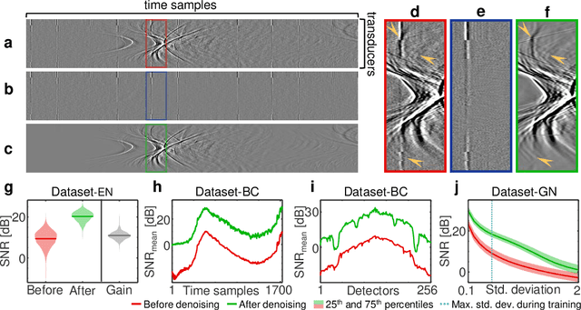 Figure 3 for Deep learning based electrical noise removal enables high spectral optoacoustic contrast in deep tissue