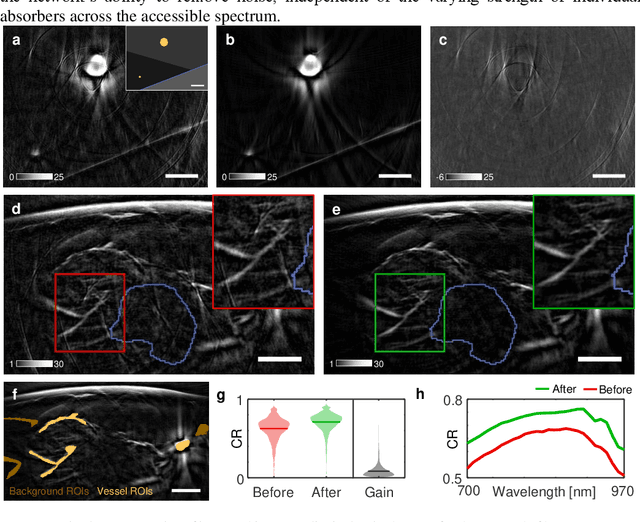 Figure 4 for Deep learning based electrical noise removal enables high spectral optoacoustic contrast in deep tissue